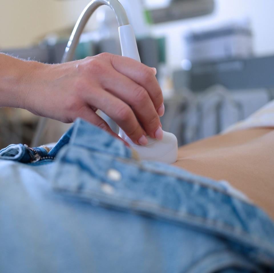 Depending on your levels of CA125, your GP might refer you for an ultrasound