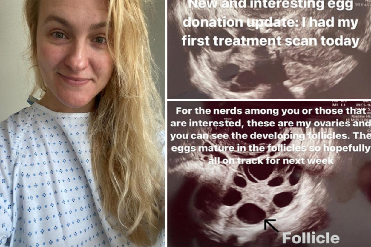 A UK medical writer who doesn't think she wants to have children has donated 88 eggs to help four couples create families. She said the process is 