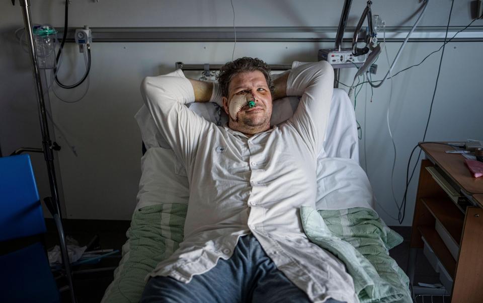 Par Sundstrom, 42, and his 14-year-old son Evert had been on duty since early morning during the first day of the bear hunt in Ljusdal, Sweden. Just as they were about to go home, a bear suddenly appeared. The bear ran towards Par, who tried to shoot at the head. But the bear was faster and bit his cheek. Par fired, but the shot did not stop the bear, which was now tearing at him. Then Evert, who practices karate, decided to hit the bear with a hard karate blow to the head. The bear then bit Evert's arm while Evert hit the animal's head with his other hand.