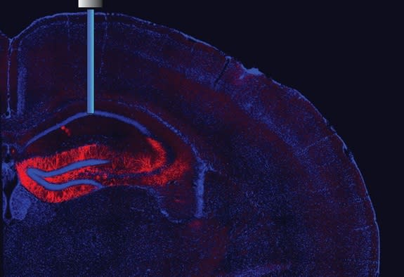 Image shows a magnified part of a mouse's brain where an optic fiber is inserted to switch neurons on and off.