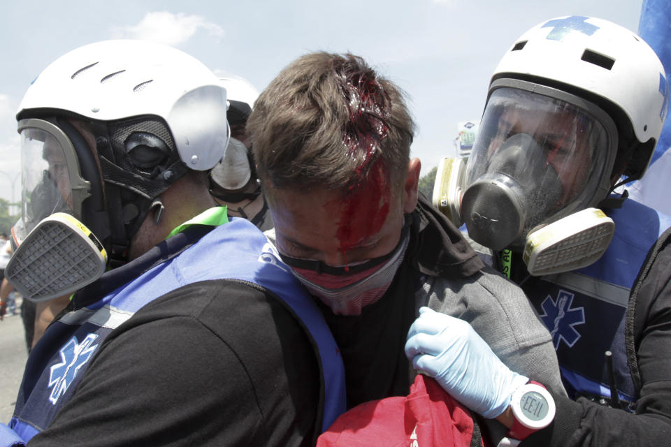 FOTOS | Enfrentamientos en Venezuela tras llamado de Guaidó a la rebelión militar