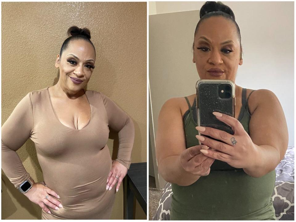 Raquel Ortiz, a Latina woman who has had gastric bypass surgeries, poses in two "after" photos.