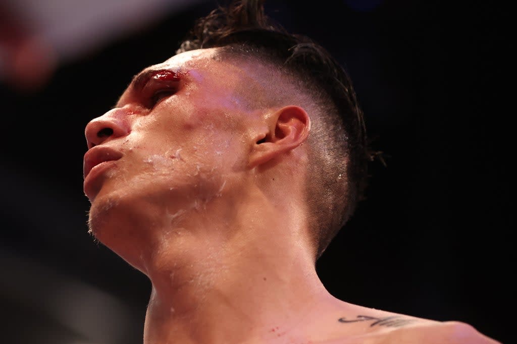 Mauricio Lara was cut during an accidental clash of heads in Leeds  (Action Images via Reuters)