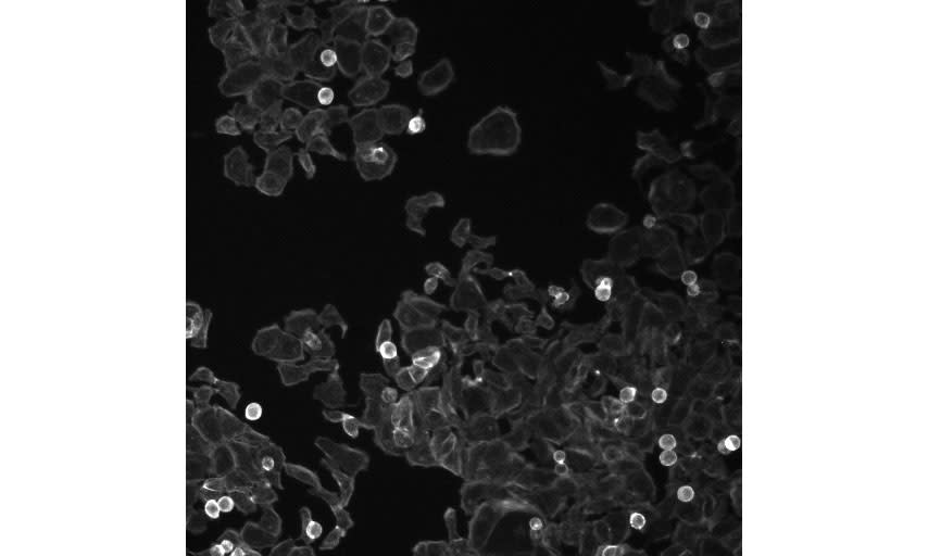 Image of Human HT29 Cells which are highlighted in Cell Profiler, the Carpenter-Singh software platform used to examine cellular images. 