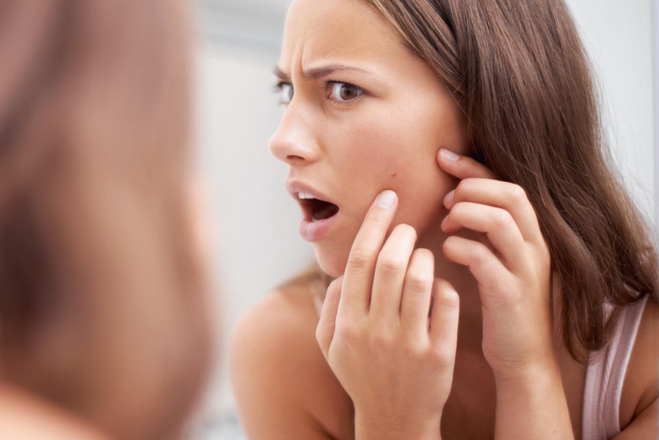 臉部頭皮出油，或是痘痘粉刺都可能是濕氣重。（圖片來源：Getty Image）
