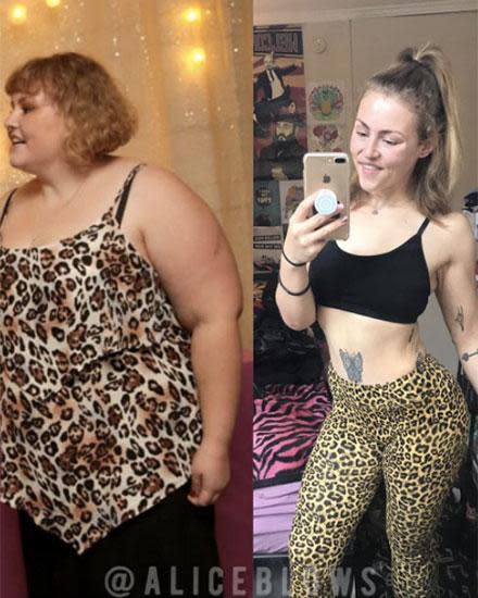 Woman S Incredible 70kg Weight Loss Transformation