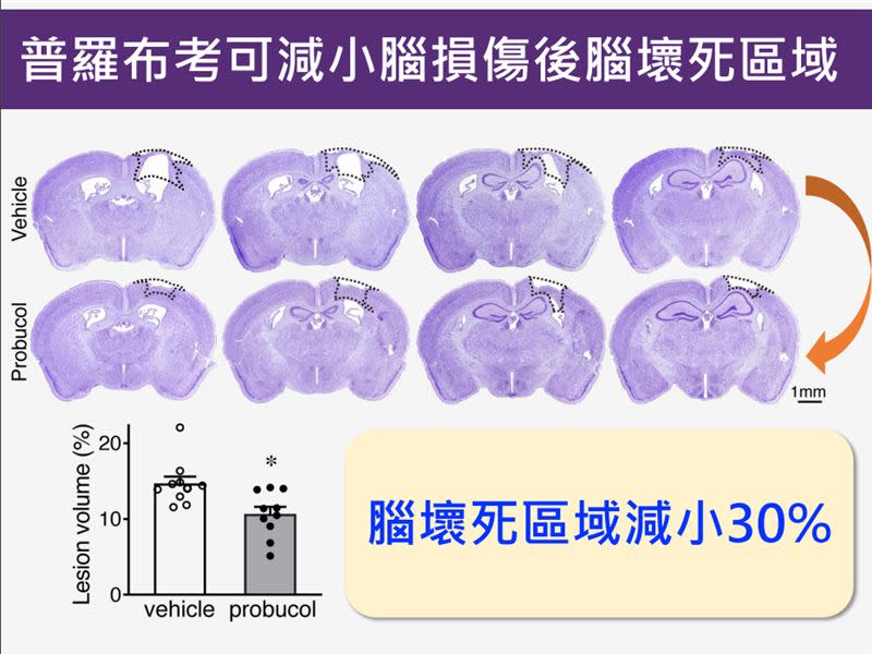 在腦損傷後給予普羅布考，小鼠腦壞死區域減小33%。（圖／國衛院提供）