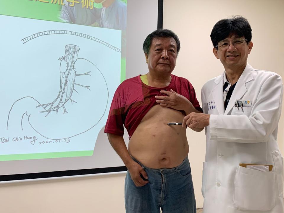 65歲陳先生吃東西就反芻，胃食道逆流微創三合一手術，解決50年困擾。（圖：台中醫院提供）