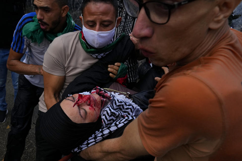 Protesters carry an injured woman during a demonstration, in solidarity with the Palestinian people in Gaza, near the U.S. Embassy in Aukar, a northern suburb of Beirut, Lebanon, Wednesday, Oct. 18, 2023. Hundreds of angry protesters are clashing with Lebanese security forces in the Lebanese suburb Aukar near the United States Embassy. (AP Photo/Bilal Hussein)