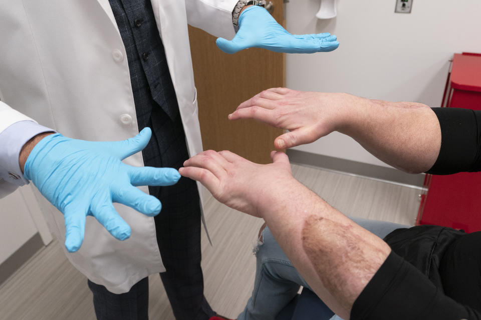 Joe DiMeo, right, demonstrates the flexibility in his fingers for Dr. Eduardo Rodriguez, Monday, Jan. 25, 2021 at NYU Langone Health in New York. A surgical team, led by Rodriguez, amputated both of DiMeo’s hands, replacing them mid-forearm and connecting nerves, blood vessels and 21 tendons with hair-thin sutures. The scar on DiMeo's forearm shows where the new hand was attached. (AP Photo/Mark Lennihan)