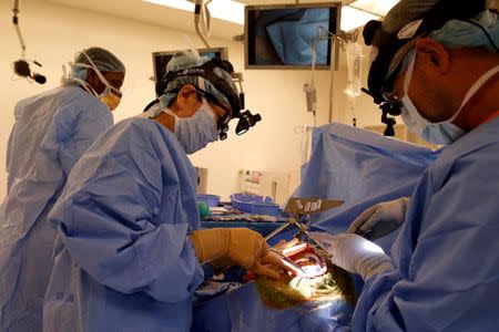 Neurosurgeon Linda Liau, MD, 49, Professor and Director of the UCLA Brain Tumor Program (C) removes a brain tumour from a patient at the Ronald Reagan UCLA Medical Center in Los Angeles, California, United States, May 26, 2016. REUTERS/Lucy Nicholson