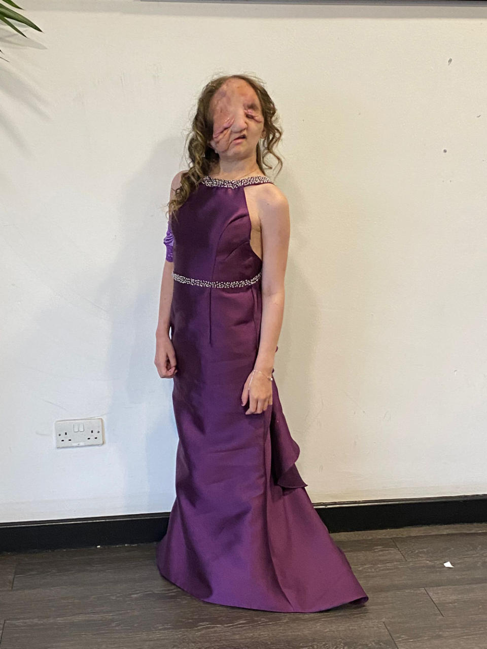Lizzy in her purple prom dress before her end-of-year sixth form ball (Collect/PA Real Life)