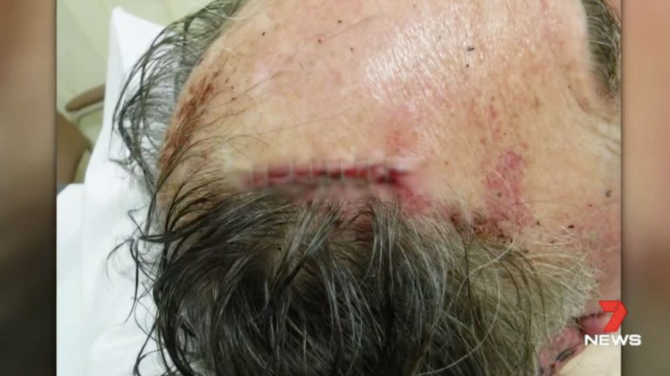 A 71-year-old man ended up in the trauma unit after a vicious bashing. Source: 7 News