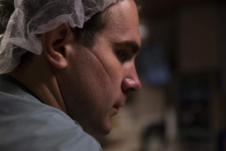 With an indentation visible on his face, nurse Spencer Cushing, 29, leans on a desk briefly after assisting a COVID-19 patient at St. Jude Medical Center in Fullerton, Calif., Tuesday, July 7, 2020. For the month of April, the Cushing family lived apart. Cushing spent his days and some of his nights at St. Jude's, as a nurse caring for "step-down" patients recovering from the most serious COVID-19 symptoms.(AP Photo/Jae C. Hong)