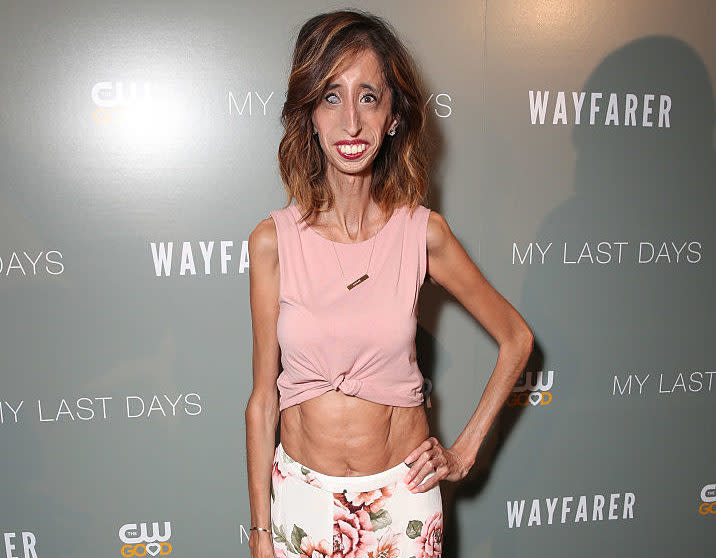 Here is another reminder that “world’s ugliest woman” Lizzie Velasquez is SUCH an incredible beauty role model