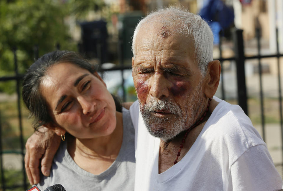 FILE - In this July 11, 2018, file photo, Aurelia Rodriguez, left, holds her father, Rodolfo Rodriguez, 92, as he thanks well-wishers for their help, as he talks to the media gathered outside his home in Los Angeles. The Los Angeles County District Attorney's office says Laquisha Jones pleaded no contest to elder abuse Thursday, Dec. 27, 2018. She faces up to 15 years in prison at her sentencing on Feb. 28. Rodriguez was repeatedly beaten by Jones in the face with a brick on July 4 while taking a walk in the unincorporated Willowbrook area. (AP Photo/Damian Dovarganes, File)