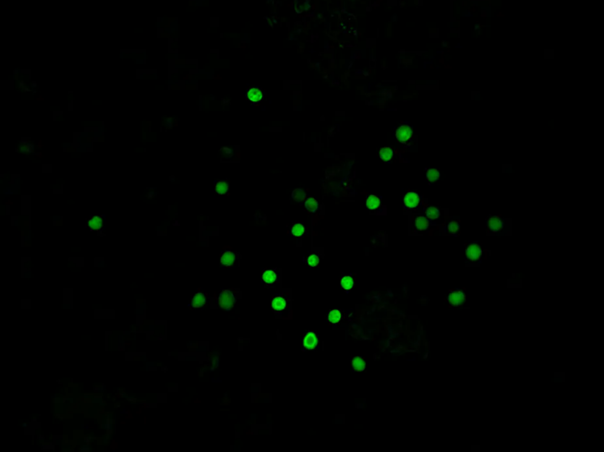 <span class="caption">Image montrant des Crocosphaera, un type de bactéries diazotrophes indispensables à la vie dans les océans. </span> <span class="attribution"><span class="license">Author provided</span></span>