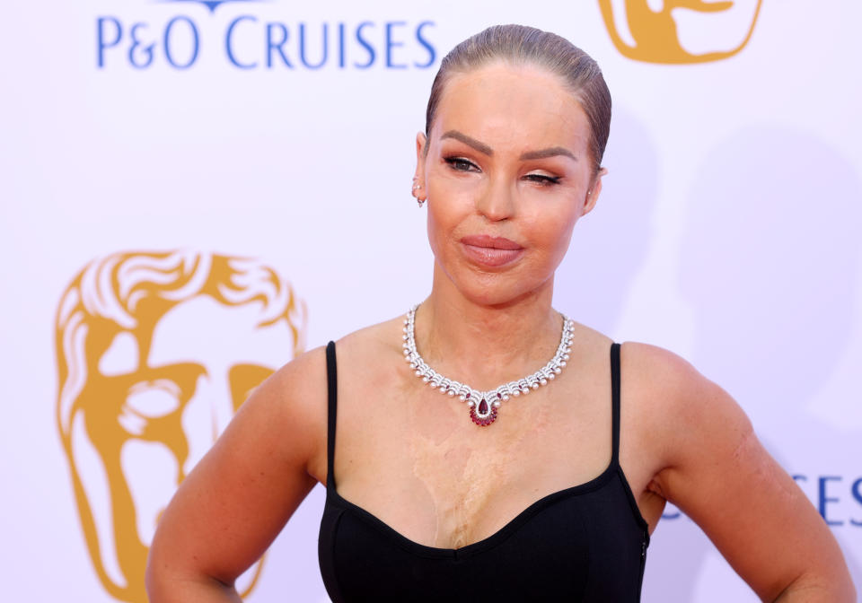 LONDON, ENGLAND - MAY 12: Katie Piper attends the BAFTA Television Awards 2024 with P&O Cruises at The Royal Festival Hall on May 12, 2024 in London, England. (Photo by Mike Marsland/WireImage)