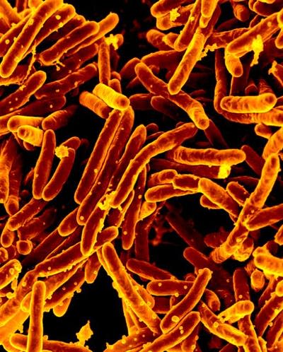 <span class="caption">Magnified image of the bacteria that causes tuberculosis.</span> <span class="attribution"><span class="source">NIAID</span>, <a class="link " href="http://creativecommons.org/licenses/by/4.0/" rel="nofollow noopener" target="_blank" data-ylk="slk:CC BY">CC BY</a></span>