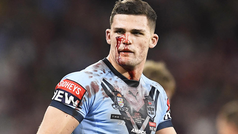 Nathan Cleary wasn't sent from the field for more than 30 minutes despite bleeding from the face.