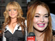 Lindsay Lohan no solo ha demostrado que tiene problemas para controlar su adicción a las sustancias ilegales, sino también al quirófano. Esta joven se ha aumentado 20 años de edad tras una serie de cirugías innecesarias.