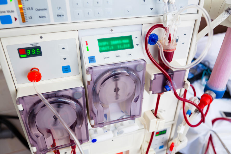 arlificial kidney (dialysis) device with rotating pumps. closeup view.