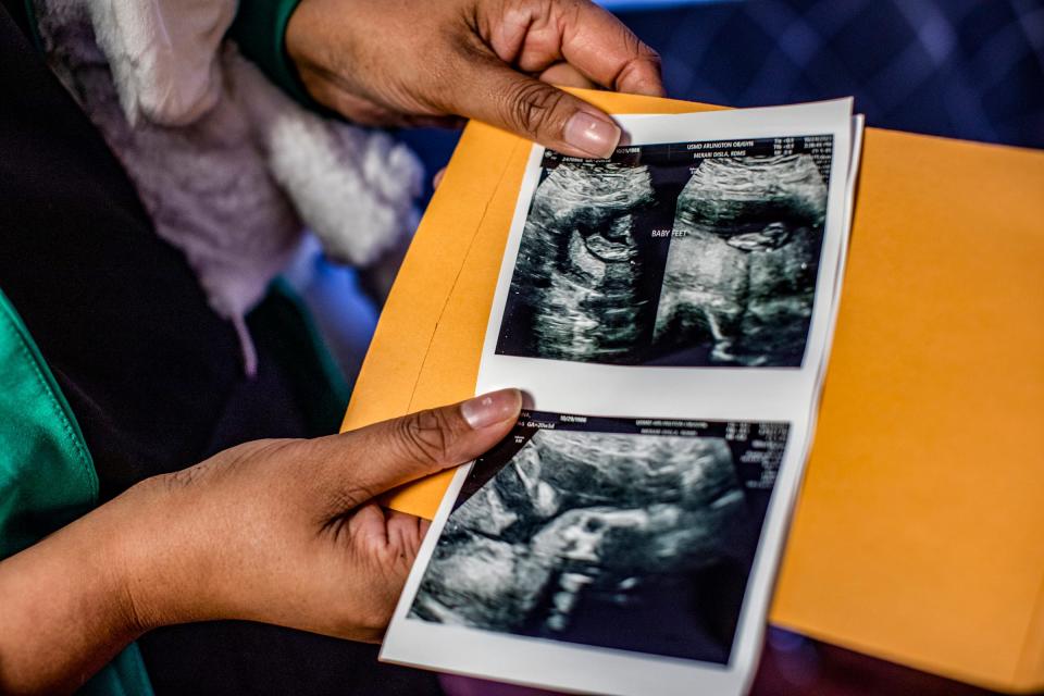 Sveta Prakash Desai, 40, of Troy, holds up a recent sonogram she received from her surrogate after a successful in vitro fertilization at her home on Nov. 16, 2023. Desai has breast cancer that is currently in remission. She wanted to have a child after completing cancer treatment, but her body didn't cooperate. After five failed eggs following a retrieval (before her diagnosis) and an aggressive cancer, Sveta is now expecting a baby via surrogate this March.