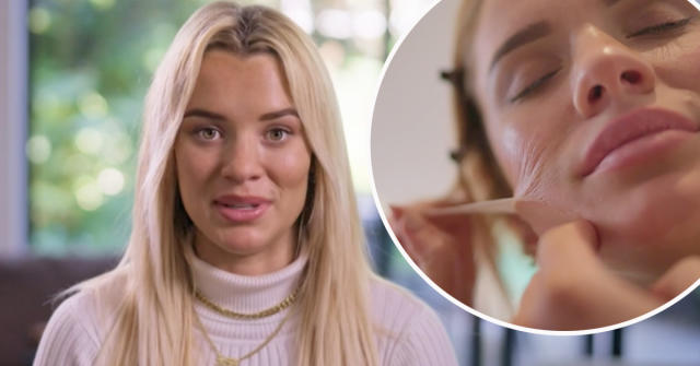 Big Brother's Tilly slammed for glue facial and freckle tattoo