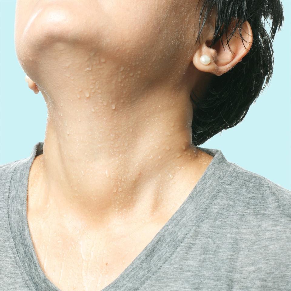 But researchers may have found the key to preventing the disease — in human sweat. plpchirawong – stock.adobe.com