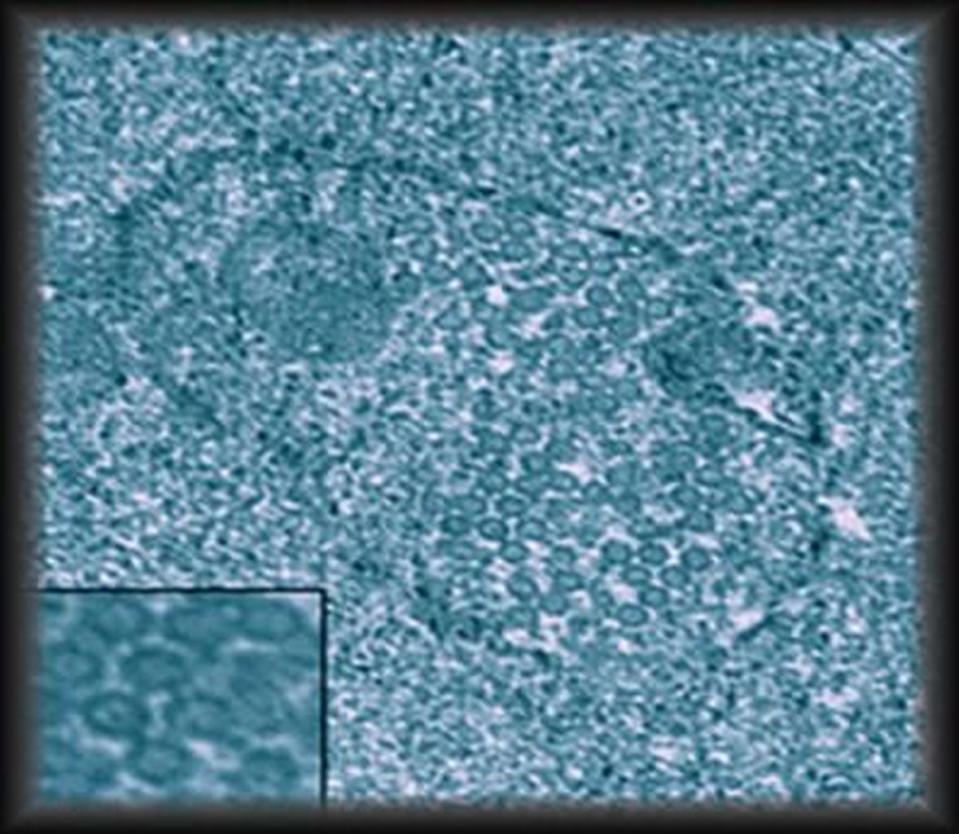 Virus particles (shown in inset) infect the symbionts of the <em>Wolbachia</em> bacterium. <cite>Michelle Marshall and Seth Bordenstein</cite>