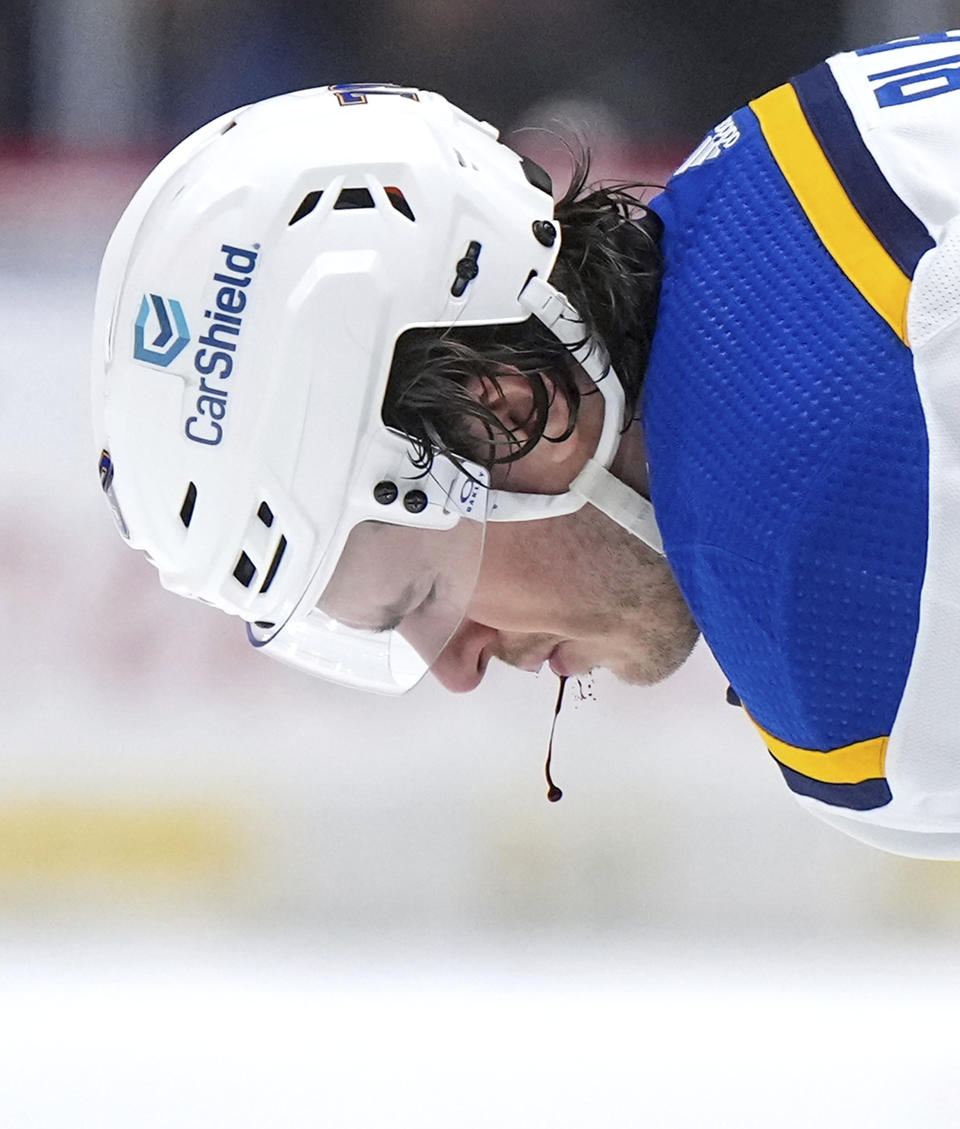 St. Louis Blues' Sammy Blais bleeds after taking a stick to the face from Vancouver Canucks' Andrei Kuzmenko during the second period of an NHL hockey game Wednesday, Jan. 24, 2024, in Vancouver, British Columbia. (Darryl Dyck/The Canadian Press via AP)