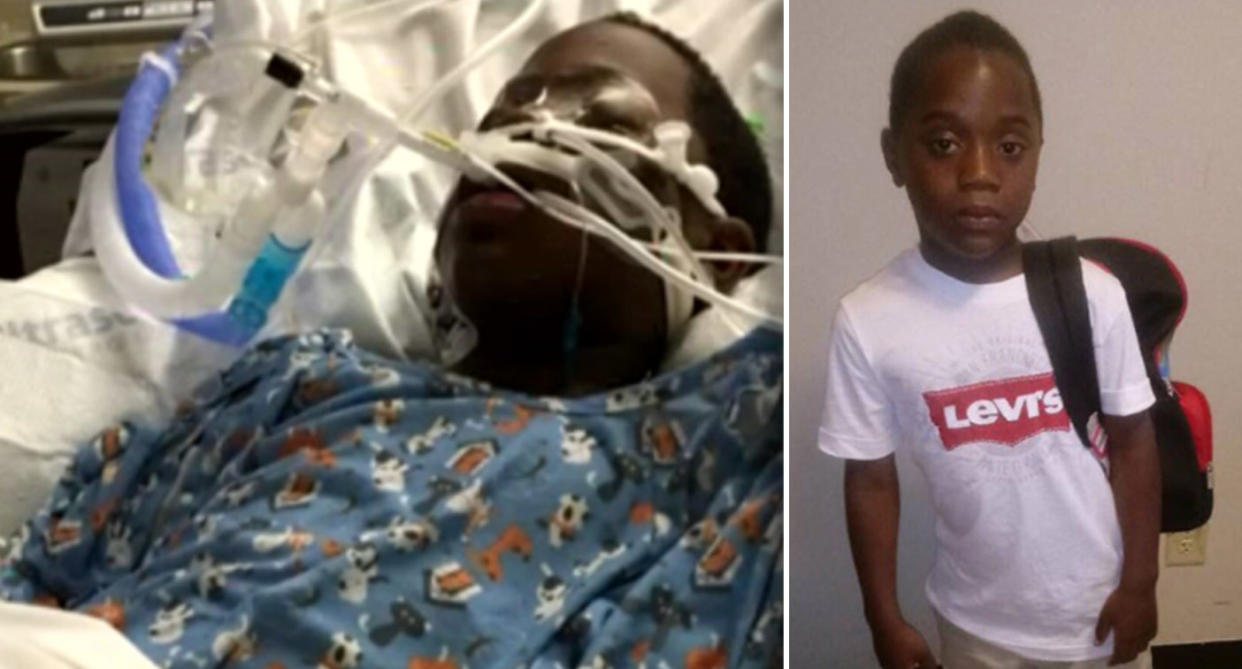 Sanquon King, 8, is now in a critical condition after he accidentally set himself on fire. (Images: WSB-TV)