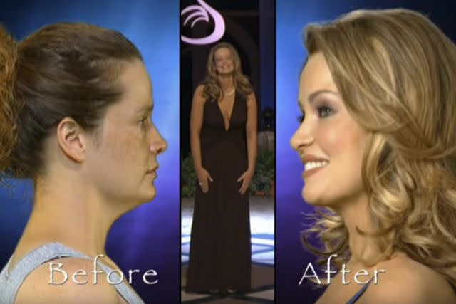 <p>FOX</p> A before and after moment on Fox's 'The Swan'