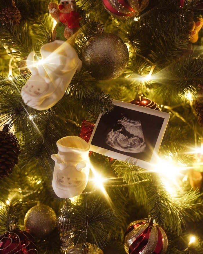 The baby's ultrasound image on the tree