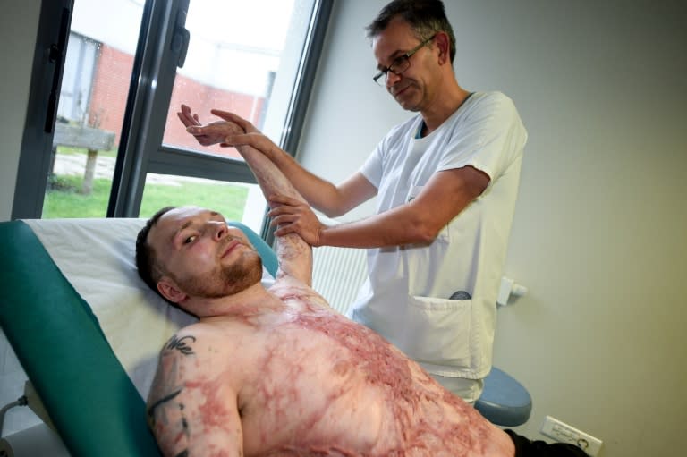 Franck Dufourmantelle received life-saving grafts from his brother Eric's skull, back and thighs