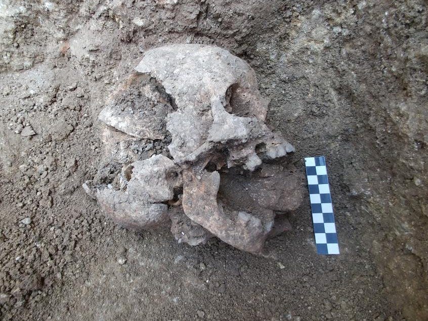 A skull is seen in situ, a rock is placed in the child's mouth.