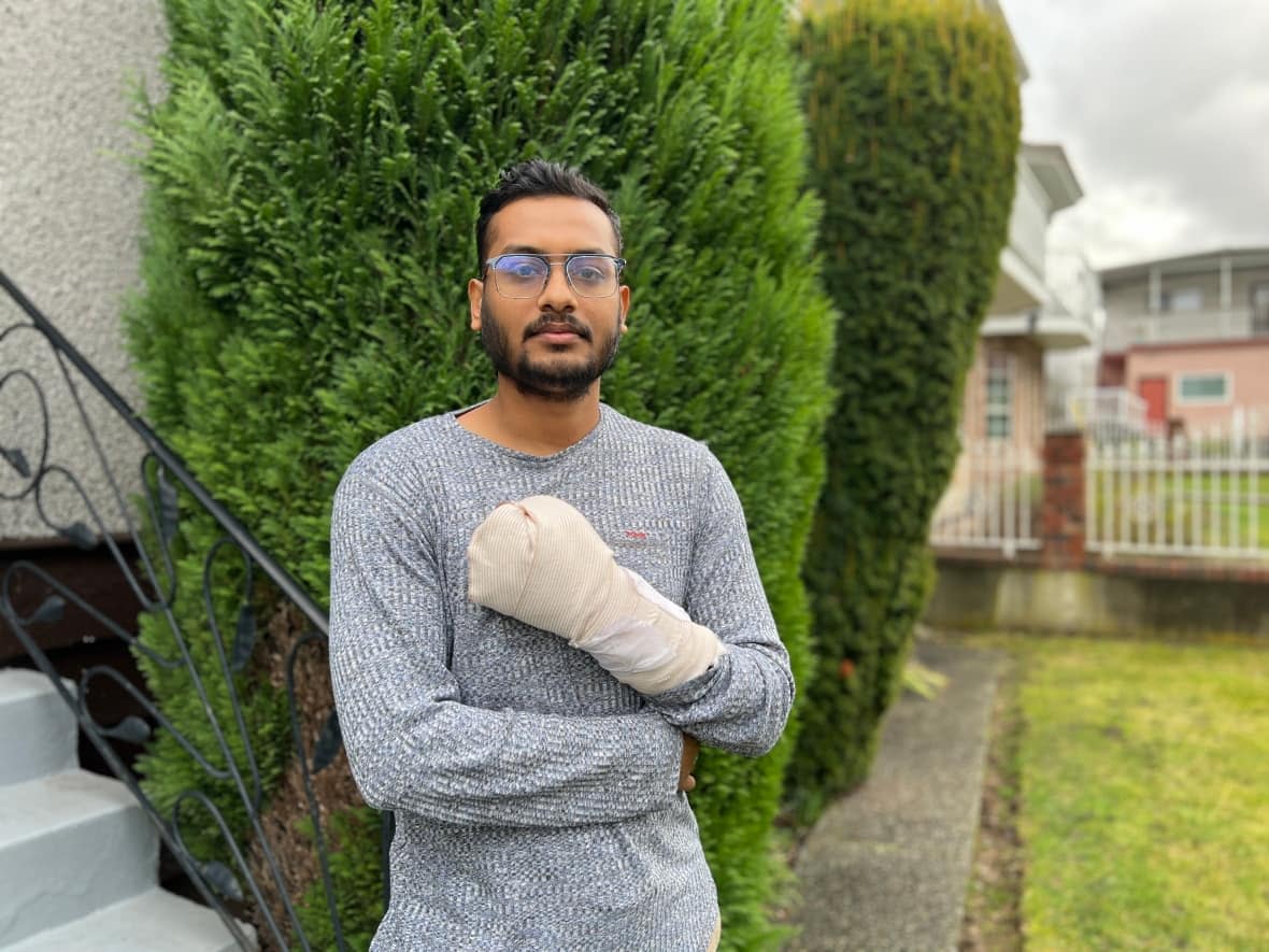 Meraj Ahmed has had his $2,000 bill for surgery and medical treatment waived. Ahmed did not have MSP, the provincial insurance plan, when he was stabbed confronting a thief on Boxing Day. (Submitted by Meraj Ahmed - image credit)