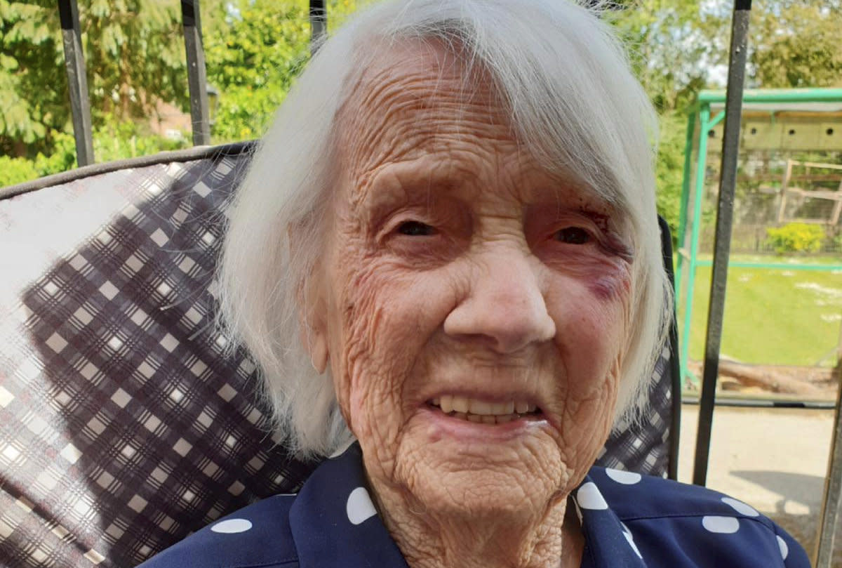 Jane Collins has been through a lot in her 104 years of life. (SWNS)