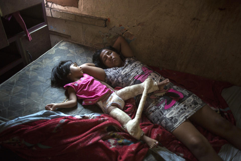 In this March 19, 2020 photo, Nilu Asca and her 2-year-old daughter Darleth, who wears a spica cast to treat hip dysplasia, sleep inside their small room inside a building nicknamed “Luriganchito,” after the country’s most populous prison, in Lima, Peru. The 24-year-old single mother spends her days begging to provide for her two children and raise the 10 soles, about three U.S. dollars, for her daily lodging expense. (AP Photo/Rodrigo Abd)