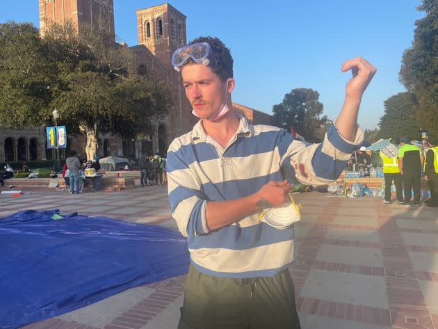 UCLA junior Aidan Doyle, 21, described being attacked by counter-protesters as 