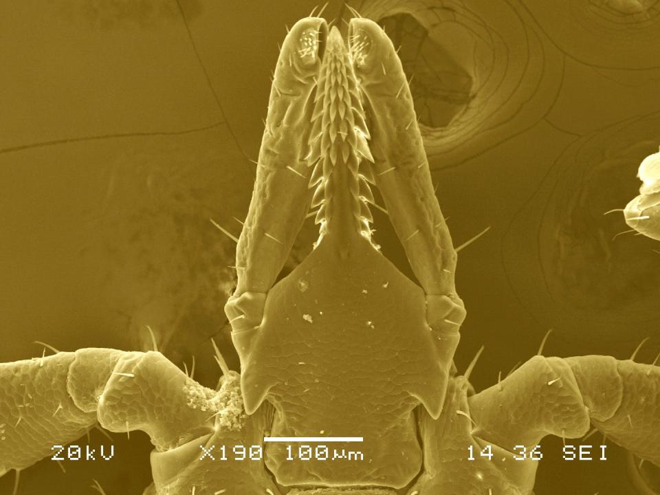 <span class="caption">A closeup of a tick’s head under an electron microscope.</span> <span class="attribution"><a class="link " href="https://biology.richmond.edu/research/research-labs/brinkerhoff-lab.html" rel="nofollow noopener" target="_blank" data-ylk="slk:Fernando Otalora-Luna/University of Richmond;elm:context_link;itc:0;sec:content-canvas">Fernando Otalora-Luna/University of Richmond</a>, <a class="link " href="http://creativecommons.org/licenses/by/4.0/" rel="nofollow noopener" target="_blank" data-ylk="slk:CC BY;elm:context_link;itc:0;sec:content-canvas">CC BY</a></span>