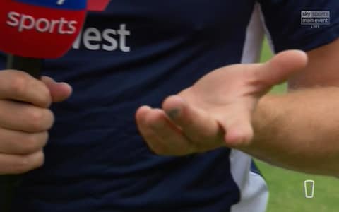 Bairstow's finger - Credit: Sky Sports