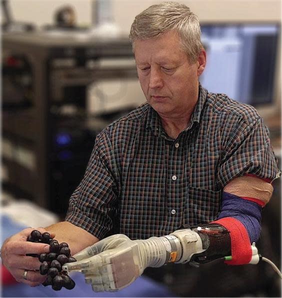 The motorised prosthetic has been named Luke after the prosthetic arm used by Star Wars character Luke Skywalker (University of Utah College of En)