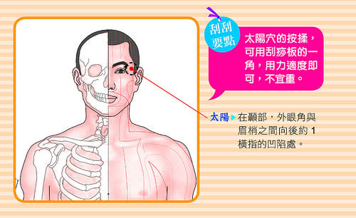 太陽穴的按揉，可用刮痧板的一角，用力適度不宜重。