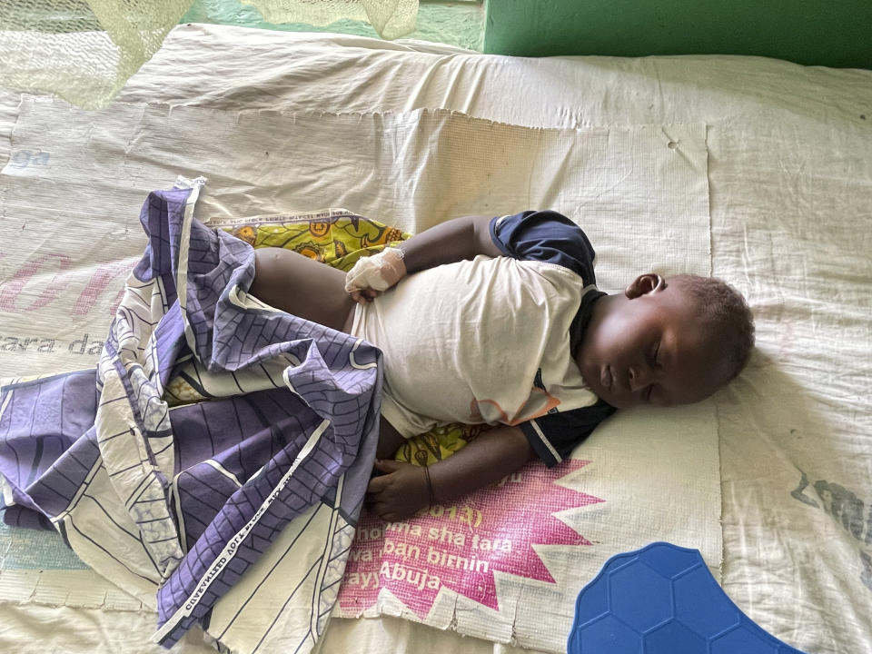 Christian Jonathan, de nueve meses, se recupera dentro de un hospital en Kunji, en el sur de Kaduna, Nigeria, el jueves 27 de abril de 2023. Hombres armados hirieron de bala a Christian en la pierna, le cortaron un dedo y mataron a su madre en abril de 2023. (Foto AP/Chinedu Asadu)