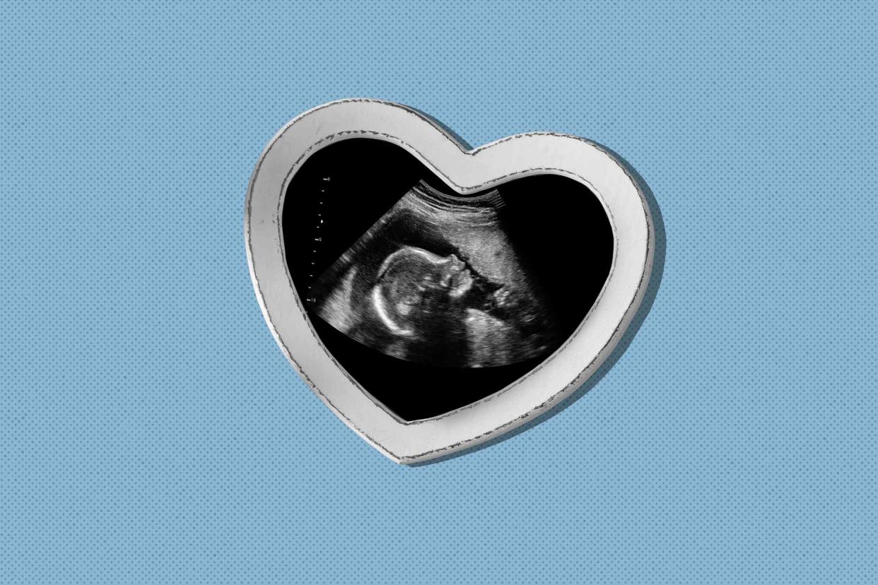sonogram in a heart photo frame