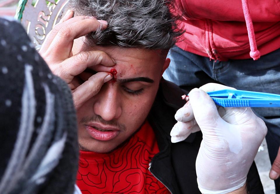 A paramedic removes the pellet from an anti-government protester's face who was shot with an air rifle by police during clashes with security forces in Baghdad, Iraq, Wednesday, Jan. 29, 2020. (AP Photo/Hadi Mizban)