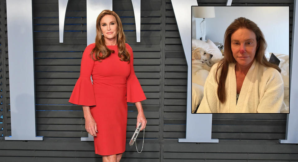 Caitlyn Jenner took to Instagram to stress the important of correct skincare in the sun. [Photo: Getty/Instagram @Caitlyn Jenner]