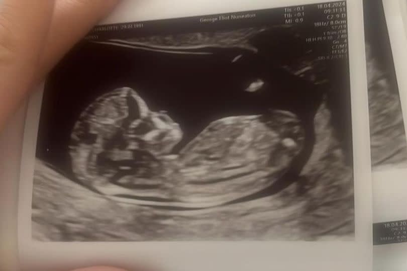 Charlotte also shared a snap of her baby scan