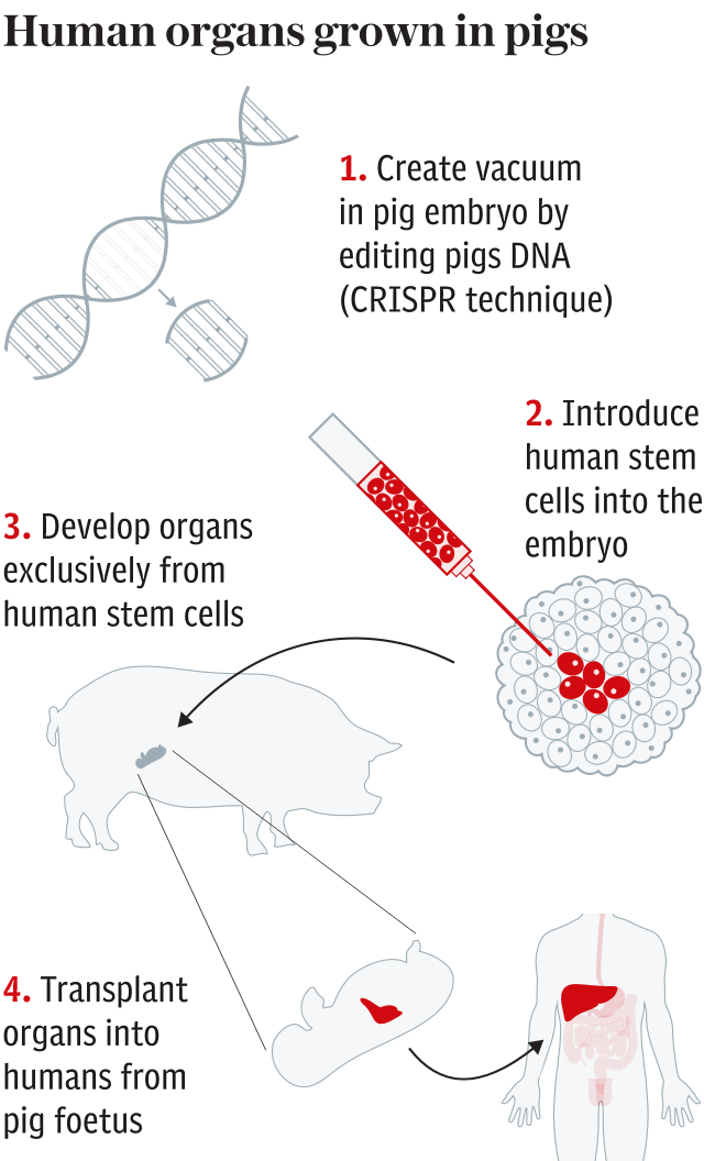 Human organs grown in pigs